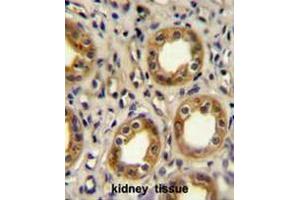 CXCR3 Antibody (Center) immunohistochemistry analysis in formalin fixed and paraffin embedded human kidney tissue followed by peroxidase conjugation of the secondary antibody and DAB staining. (CXCR3 antibody  (Middle Region))