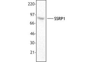 Image no. 1 for anti-Structure Specific Recognition Protein 1 (SSRP1) antibody (ABIN205478) (SSRP1 antibody)