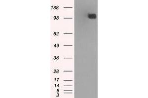 Image no. 11 for anti-Budding Uninhibited By Benzimidazoles 1 Homolog beta (Yeast) (BUB1B) antibody (ABIN1496996) (BUB1B antibody)