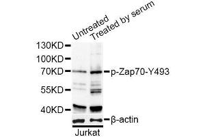 Western blot analysis of extracts of Jurkat cells, using Phospho-ZAP70-Y493 antibody (ABIN2988352) at 1/1000 dilution. (ZAP70 antibody  (pTyr493))