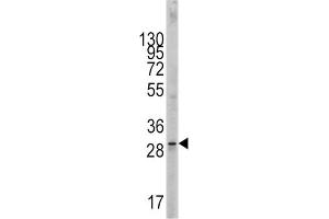 Western Blotting (WB) image for anti-KIT Ligand (KITLG) antibody (ABIN2998288) (KIT Ligand antibody)