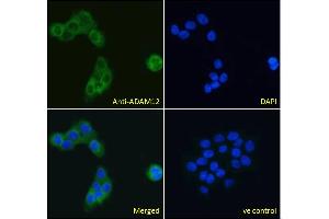 ABIN185301 Immunofluorescence analysis of paraformaldehyde fixed A431 cells, permeabilized with 0. (ADAM12 antibody  (N-Term))