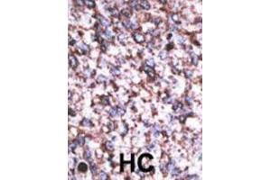 Immunohistochemistry (IHC) image for anti-beta-Site APP-Cleaving Enzyme 2 C (BACE2 C) antibody (ABIN2995239) (BACE2C antibody)