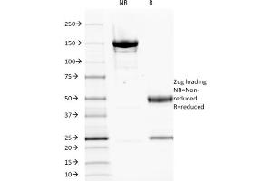 SDS-PAGE Analysis Purified EGFR Mouse Monoclonal Antibody (GFR1195). (EGFR antibody  (Extracellular Domain))