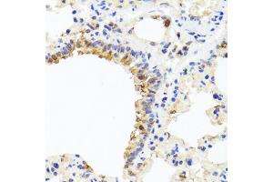 Immunohistochemistry of paraffin-embedded rat lung using CXCL8 antibody (ABIN6290535) at dilution of 1:100 (40x lens). (IL-8 antibody)