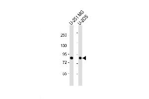 Western Blotting (WB) image for anti-GIT1 (GIT1) (AA 366-395) antibody (ABIN5533601)