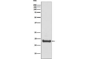 Western blot analysis of ARF6 expression in 293T cell lysate. (Recombinant ARF6 antibody)