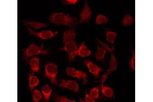 ABIN6266873 staining Hela by IF/ICC. (STEAP4 antibody  (C-Term))