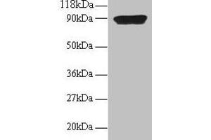 Western blot All lanes: CXCL5 antibody at 2 μg/mL + 293T whole cell lysate Secondary Goat polyclonal to rabbit IgG at 1/15000 dilution Predicted band size: 12 kDa Observed band size: 90 kDa (CXCL5 antibody  (AA 37-110))
