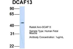 Host: Rabbit  Target Name: DCAF13  Sample Tissue: Human Fetal Muscle  Antibody Dilution: 1. (DCAF13 antibody  (N-Term))