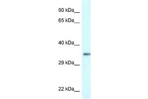 WB Suggested Anti-PDLIM1 Antibody Titration: 1. (PDLIM1 antibody  (C-Term))
