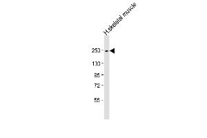 Anti-MYH4 Antibody (N-Term) at 1:1000 dilution + human skeletal muscle lysate Lysates/proteins at 20 μg per lane. (MYH4 antibody  (AA 346-380))