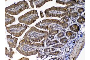 Immunohistochemistry (IHC) image for anti-Mediator Complex Subunit 9 (MED9) (AA 55-146) antibody (ABIN5519032)