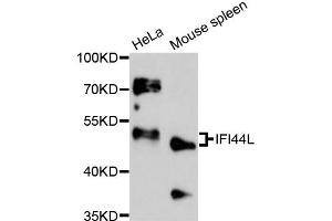 Western Blotting (WB) image for anti-Interferon-Induced Protein 44-Like (IFI44L) antibody (ABIN6292158)
