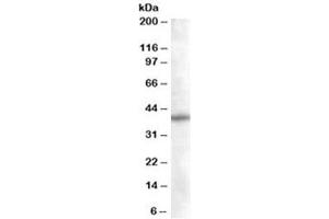Western blot testing of Daudi lysate with SNX16 antibody at 0. (SNX16 antibody)