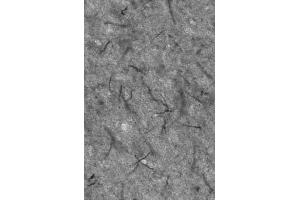 Adult rat thalamus immunohistochemistry of axon initial segments.