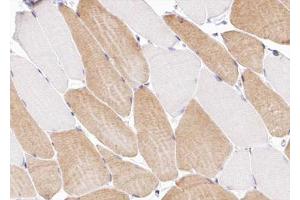 ABIN6266991 at 1/100 staining human Skeletal muscle tissue sections by IHC-P. (COL12A1 antibody  (Internal Region))