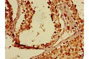 Immunohistochemistry of paraffin-embedded human testis tissue using ABIN7162843 at dilution of 1:100 (FKBP8 antibody  (AA 58-190))