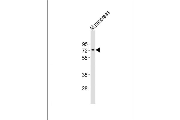 NR4A2 antibody  (AA 164-197)