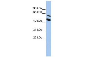 WB Suggested Anti-MMP24 Antibody Titration:  0. (MMP24 antibody  (Middle Region))