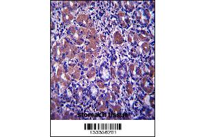 B4GALNT3 Antibody immunohistochemistry analysis in formalin fixed and paraffin embedded human stomach tissue followed by peroxidase conjugation of the secondary antibody and DAB staining. (B4GALNT3 antibody  (AA 555-584))