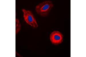 Immunofluorescent analysis of Galectin 8 staining in HepG2 cells. (LGALS8 antibody  (Center))