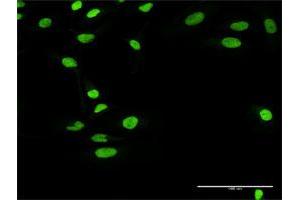 Immunofluorescence of purified MaxPab antibody to RCC1 on HeLa cell. (RCC1 antibody  (AA 1-421))