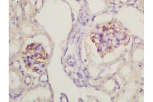 Formalin-fixed and paraffin embedded mouse kidney labeled with Rabbit Anti-Nephrin Polyclonal Antibody, Unconjugated (ABIN2177857) at 1:200 followed by conjugation to the secondary antibody and DAB staining (Nephrin antibody  (AA 451-550))