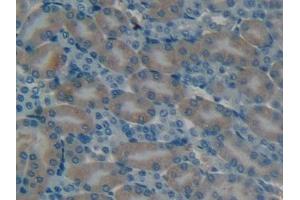 Detection of OC in Mouse Kidney Tissue using Polyclonal Antibody to Osteocalcin (OC) (Osteocalcin antibody  (AA 14-95))