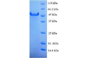 SDS-PAGE (SDS) image for Hyaluronan Binding Protein 2 (HABP2) (AA 37-313), (partial) protein (His-SUMO Tag) (ABIN4976605)