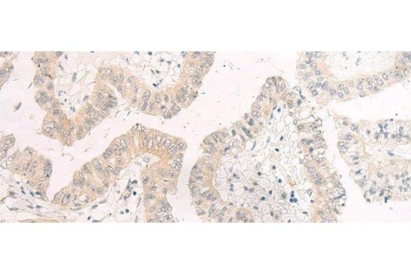GSG2 antibody
