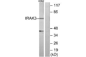 Immunohistochemistry analysis of paraffin-embedded human brain tissue using IRAK3 antibody. (IRAK3 antibody)