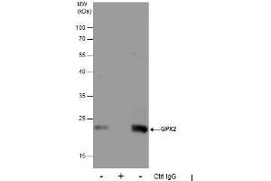 IP Image Immunoprecipitation of GPX2 protein from HepG2 whole cell extracts using 5 μg of GPX2 antibody [C1C3], Western blot analysis was performed using GPX2 antibody [C1C3], EasyBlot anti-Rabbit IgG  was used as a secondary reagent. (Glutathione Peroxidase 2 antibody  (C-Term))