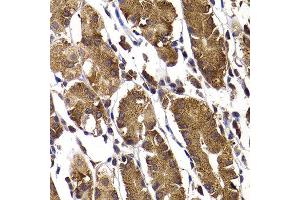 Immunohistochemistry of paraffin-embedded human stomach using STAMBP antibody at dilution of 1:100 (x400 lens). (STAMBP antibody)