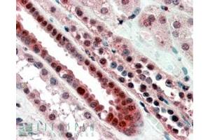 Immunohistochemistry (IHC) image for anti-Transcription Factor 3 (E2A Immunoglobulin Enhancer Binding Factors E12/E47) (TCF3) (Internal Region) antibody (ABIN190880)