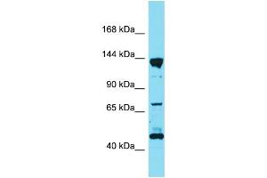Western Blotting (WB) image for anti-Liprin alpha 3 (PPFIA3) (C-Term) antibody (ABIN2791058)
