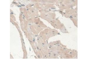 IHC-P analysis of Rat Heart Tissue, with DAB staining. (Androgen Receptor antibody  (AA 491-679))