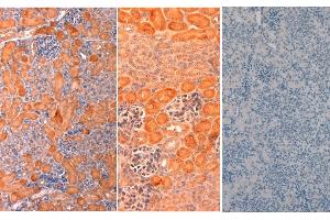 Immunohistochemistry of Rabbit anti-mouse DELTA1 Antibody in Mouse Embryonic Kidney Tissue: Mouse Embryonic Kidney Fixation: FFPE buffered formalin 10% conc Ag Retrieval: Heat, Citrate pH 6. (DLL1 antibody  (AA 150-175))
