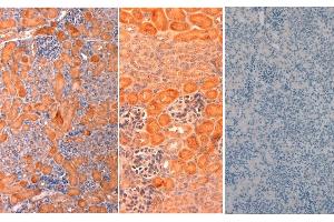 Immunohistochemistry of Rabbit anti-mouse DELTA1 Antibody in Mouse Embryonic Kidney Tissue: Mouse Embryonic Kidney Fixation: FFPE buffered formalin 10% conc Ag Retrieval: Heat, Citrate pH 6. (DLL1 antibody  (AA 155-173))