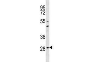 OSCAR antibody western blot analysis in 293 lysate. (OSCAR antibody  (AA 205-231))