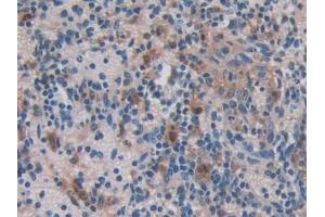 Immunohistochemistry (IHC) image for anti-Ferritin, Mitochondrial (FTMT) (AA 54-229) antibody (ABIN7437572)