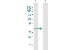 Western Blot analysis of CCDC148 expression in transfected 293T cell line by CCDC148 MaxPab polyclonal antibody. (CCDC148 antibody  (AA 1-255))