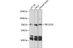 Western blot analysis of extracts of various cell lines, using TBC1D23 antibody (ABIN6133202, ABIN6148882, ABIN6148883 and ABIN6224939) at 1:3000 dilution. (TBC1D23 antibody  (AA 250-600))