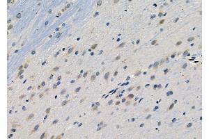 ABIN6264136 and ABIN6278994 at 1/100 staining Rat brain tissue by IHC-P.