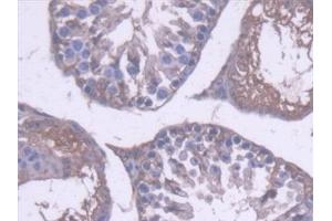 Detection of ALDH1A1 in Mouse Testis Tissue using Polyclonal Antibody to Aldehyde Dehydrogenase 1 Family, Member A1 (ALDH1A1) (ALDH1A1 antibody  (AA 1-326))