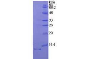 Image no. 1 for Interleukin 1 Receptor, Type I (IL1R1) (AA 21-109) (Active) protein (His tag) (ABIN5665832) (IL1R1 Protein (AA 21-109) (His tag))