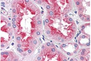 Human Kidney (formalin-fixed, paraffin-embedded) stained with SMAD9 antibody ABIN337365 at 5 ug/ml followed by biotinylated anti-goat IgG secondary antibody ABIN481715, alkaline phosphatase-streptavidin and chromogen. (SMAD9 antibody  (AA 166-179))