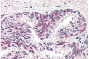 Human Prostate (formalin-fixed, paraffin-embedded) stained with MSX1 antibody ABIN337116 at 2. (MSX1 antibody  (AA 8-19))