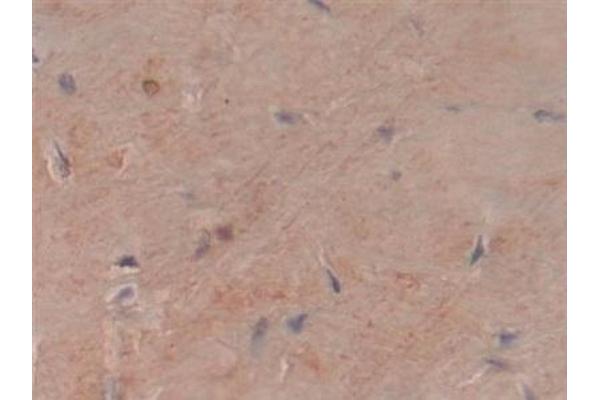 COL6a3 antibody  (AA 463-624)
