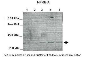Western Blotting (WB) image for anti-Nuclear Factor of kappa Light Polypeptide Gene Enhancer in B-Cells Inhibitor, alpha (NFKBIA) (Middle Region) antibody (ABIN2792229)